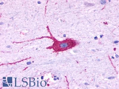 PathPlus™ LPAR6 / P2RY5 / P2Y5 Antibody (Extracellular Domain)