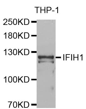 IFIH1 / MDA5 Antibody