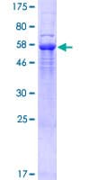 Human SEC31B Protein (Recombinant GST)