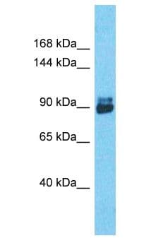 Polyclonal Rabbit anti-Human Transportin-SR / TNPO3 Antibody (aa664-713, WB)