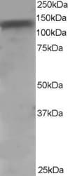 IHC-plus™ ADAM17 / TACE Antibody (C-Terminus)