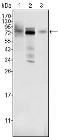 IHC-plus™ Monoclonal Mouse anti-Human MDM4 / MDMX Antibody (clone 2D10F4, aa 2-185, IHC, IF, WB)