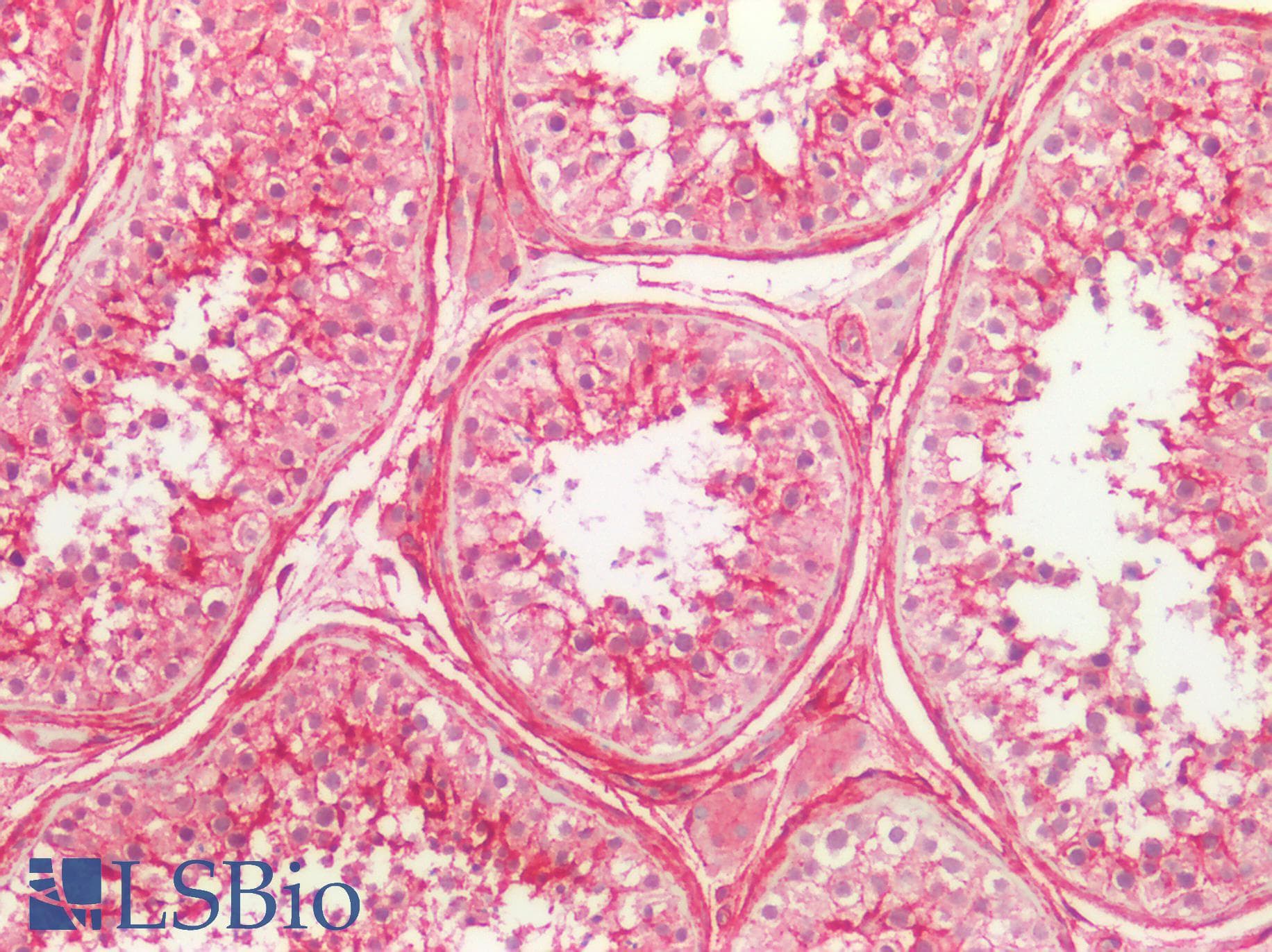 PathPlus™ CD81 Antibody (90-210 aa, Internal)
