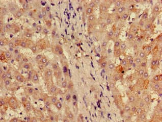 Polyclonal Rabbit anti-Human RPL28 / Ribosomal Protein L28 Antibody (Biotin, IHC, WB)