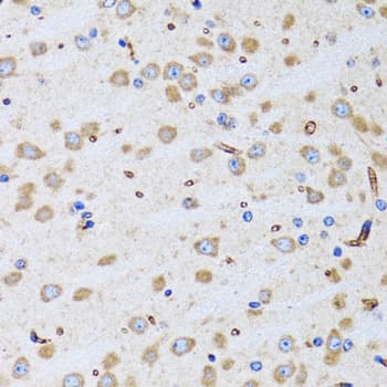 PTRH2 / BIT1 Antibody
