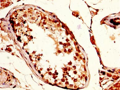 TPX2 Antibody