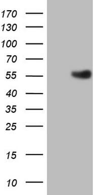 ESRRB / ERR Beta Antibody (aa1-252, clone OTI1E6)