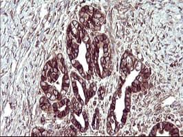 TXNDC1 / TMX1 Antibody (clone OTI1G1)