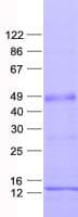 Human ZFP2 Protein (Recombinant His, N-Terminal)
