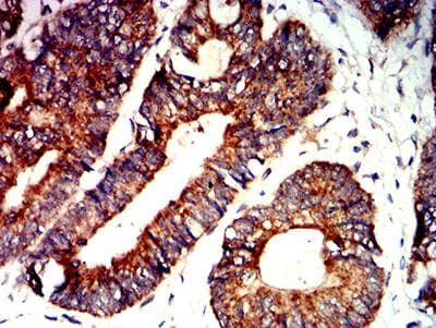 BAK1 / BAK Antibody (clone 2H9H7)