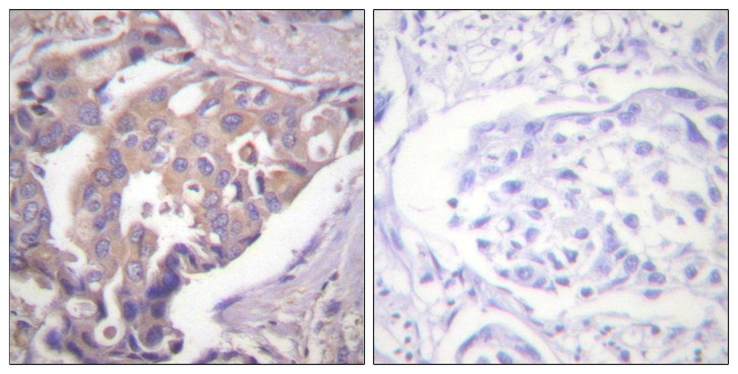 RPS6KB1 / P70S6K / S6K Antibody (p371)