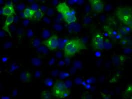 LIPG / Endothelial Lipase Antibody (clone OTI4C1, Carrier-free)