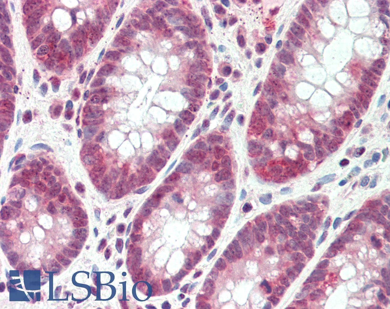IHC-plus™ Polyclonal Goat anti-Human SH2D3A / NSP1 Antibody (aa459-470, IHC, WB)