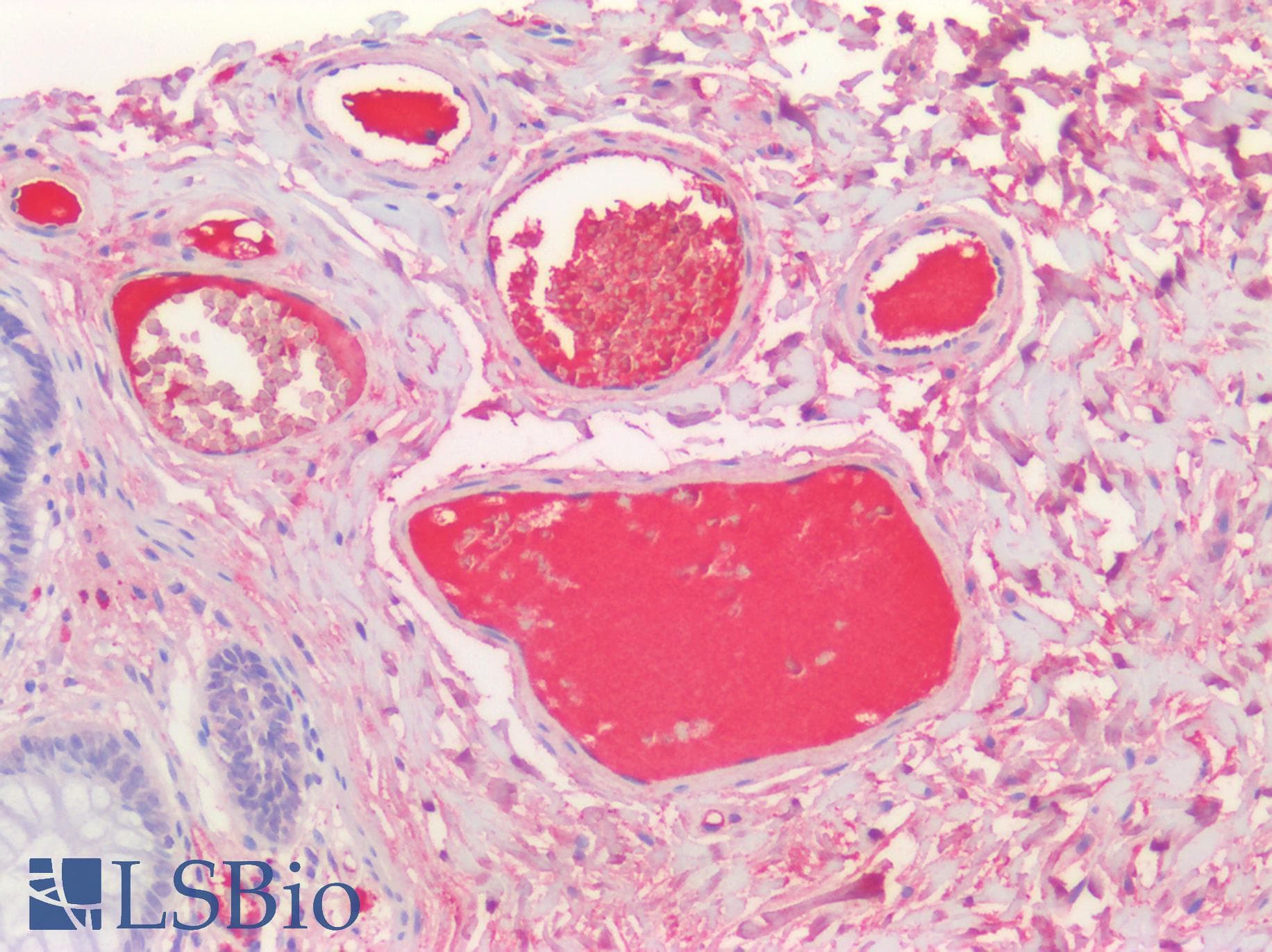 IHC-plus™ Complement C9 Antibody (clone C9-5-48)