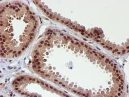 CYP17 / CYP17A1 Antibody (clone OTI3F11)