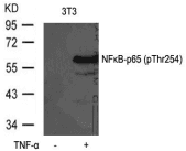 RELA / NFKB p65 Antibody
