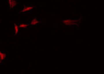 STRADA / LYK5 Antibody