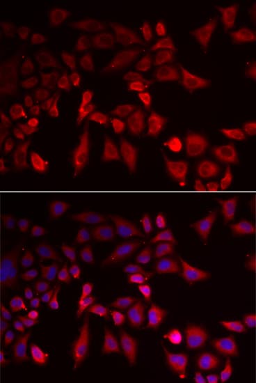 Polyclonal Rabbit anti-Human PYGL Antibody (IHC, IF, WB)