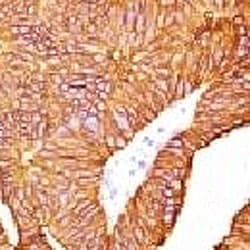 EPCAM Antibody (clone EPM17-1)