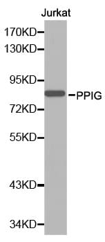 PPIG / Cyclophilin G Antibody