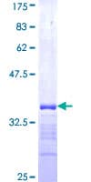 Human RNF186 Protein (Recombinant GST, N-terminus)