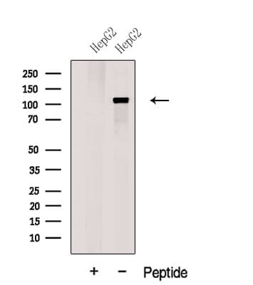 GART / GARS Antibody