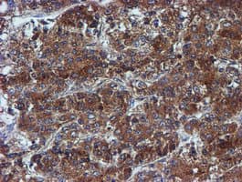 IDS / Iduronate 2 Sulfatase Antibody (clone OTI1D9)