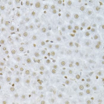 Polyclonal Rabbit anti-Human MAPK3 / ERK1 Antibody (IHC, IF, WB)