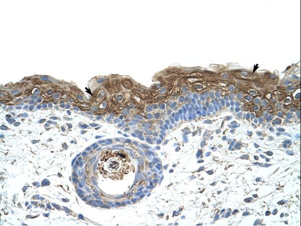 Polyclonal Rabbit anti-Human EIF2A / EIF2 Alpha Antibody (aa504-553, IHC, WB)