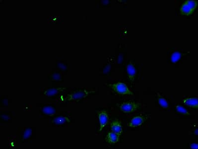 IHC-plus™ TGFA / TGF Alpha Antibody