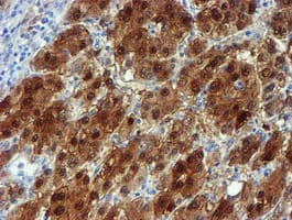 NQO2 Antibody (clone OTI1G2)