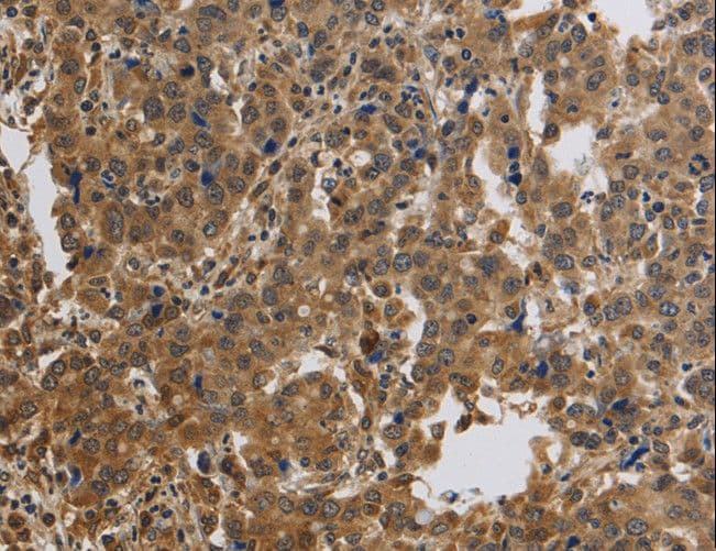 Polyclonal Rabbit anti-Human KCNMB4 Antibody (IHC, WB)
