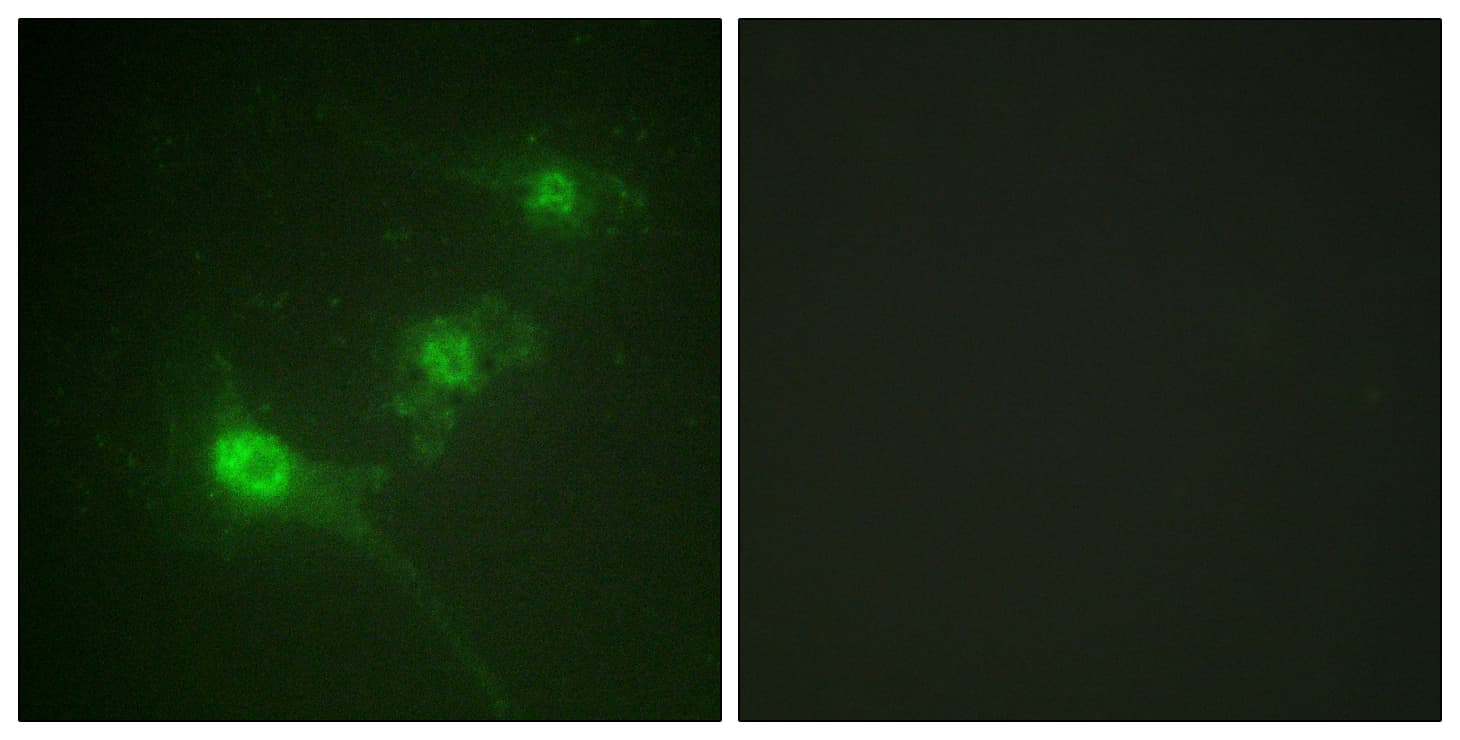 STK11 / LKB1 Antibody (phospho-Ser428)