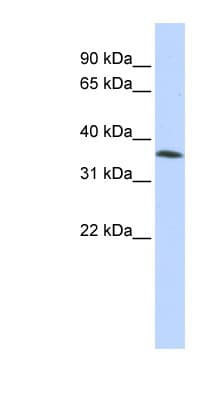 Polyclonal Rabbit anti-Human FAM164A / CGI-62 Antibody (aa144-193, WB)