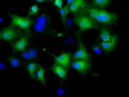 CRYM Antibody (clone OTI1B5)
