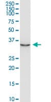 AIMP2 Antibody (clone 8E7)