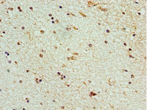 STK32A Antibody (aa1-166)