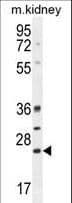 BCL10 / BCL-10 Antibody (aa24-51)