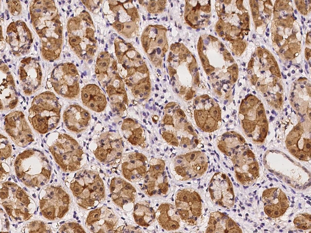 RGS11 Antibody