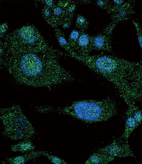 NOTCH3 Antibody (aa2291-2321)
