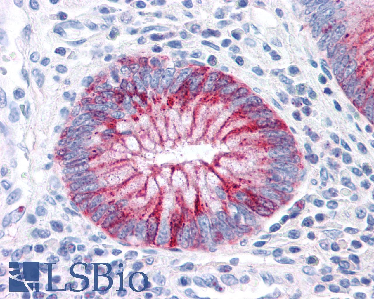 PathPlus™ GPR31 Antibody (Extracellular Domain)