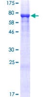 Human TRMO / C9orf156 Protein (Recombinant GST)