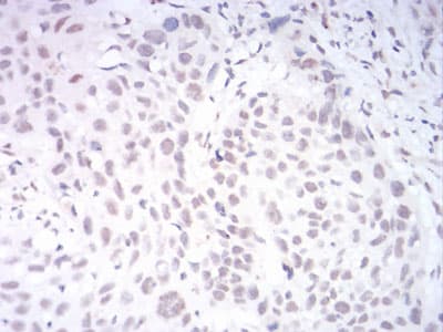 KDM1B Antibody (clone 5E10C1)