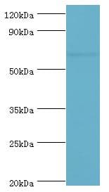 Polyclonal Rabbit anti-Human GAD1 / GAD67 Antibody (aa1-200, IHC, WB)