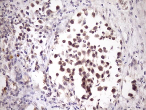 ZNF449 Antibody (clone OTI4C6, Carrier-free)