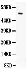 TMEM142A / ORAI1 Antibody (aa278-301)