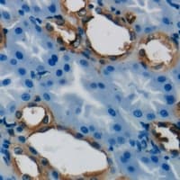 GSTT1 Antibody