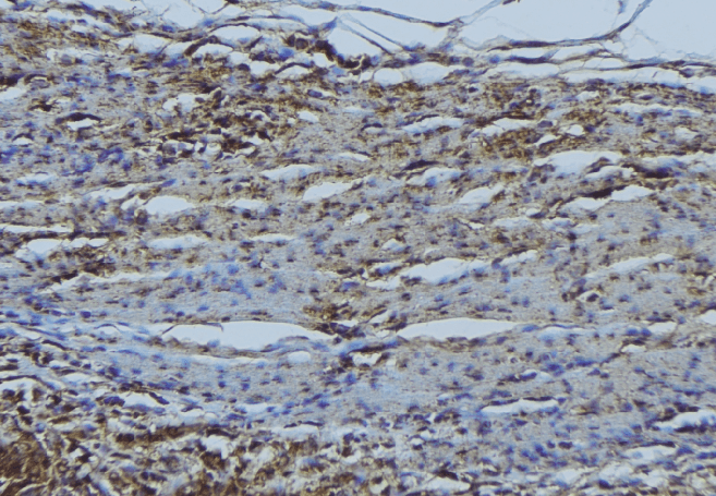 Polyclonal Rabbit anti-Human RAB7A / RAB7 Antibody (IHC, WB)