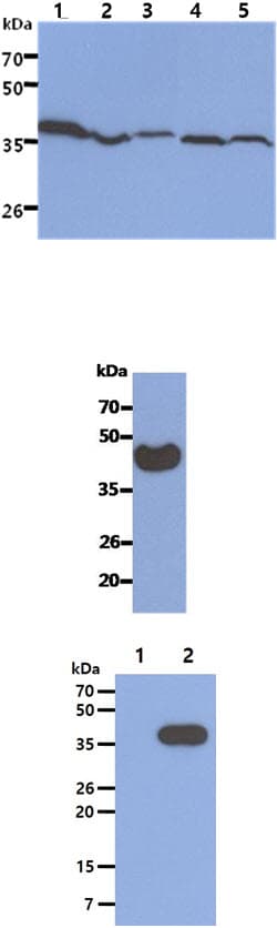 Monoclonal Mouse anti-Human ACAT2 Antibody (clone AT55D5, WB)
