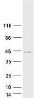 Human SAMD14 Protein (Recombinant Myc-DDK (Flag))